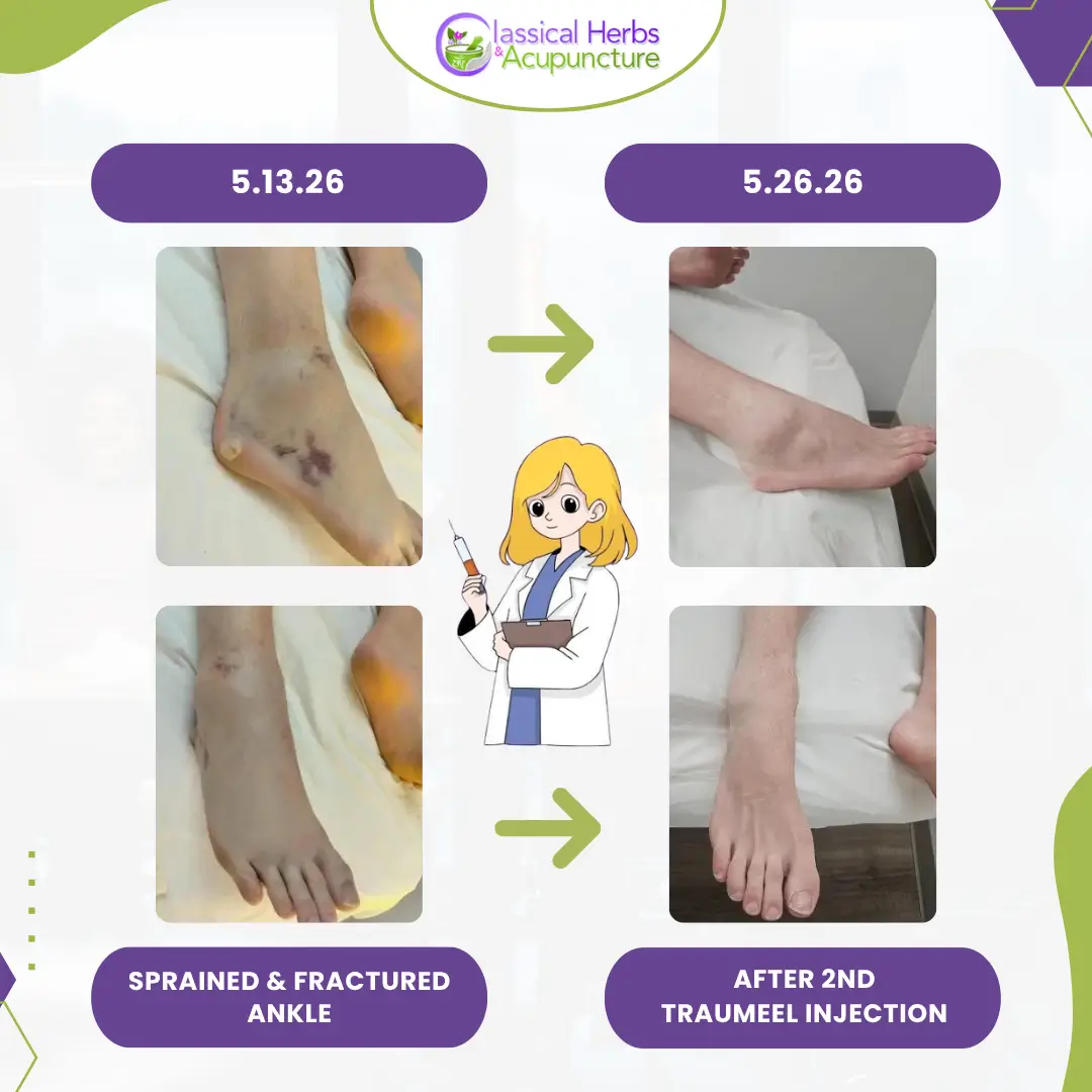 Miami Herbs - Traumeel Results Miami Herbs - Traumeel Results